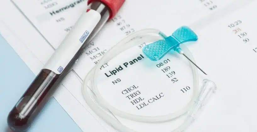 CPT Code for Lipid Panel