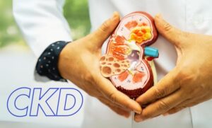 A doctor holding a model of a human kidney, representing chronic kidney disease (CKD).